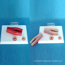 Human Pathological Vascular Medical Anatomic Model for Teaching (R120111)